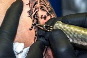 La forma más rápida de eliminar un tatuaje